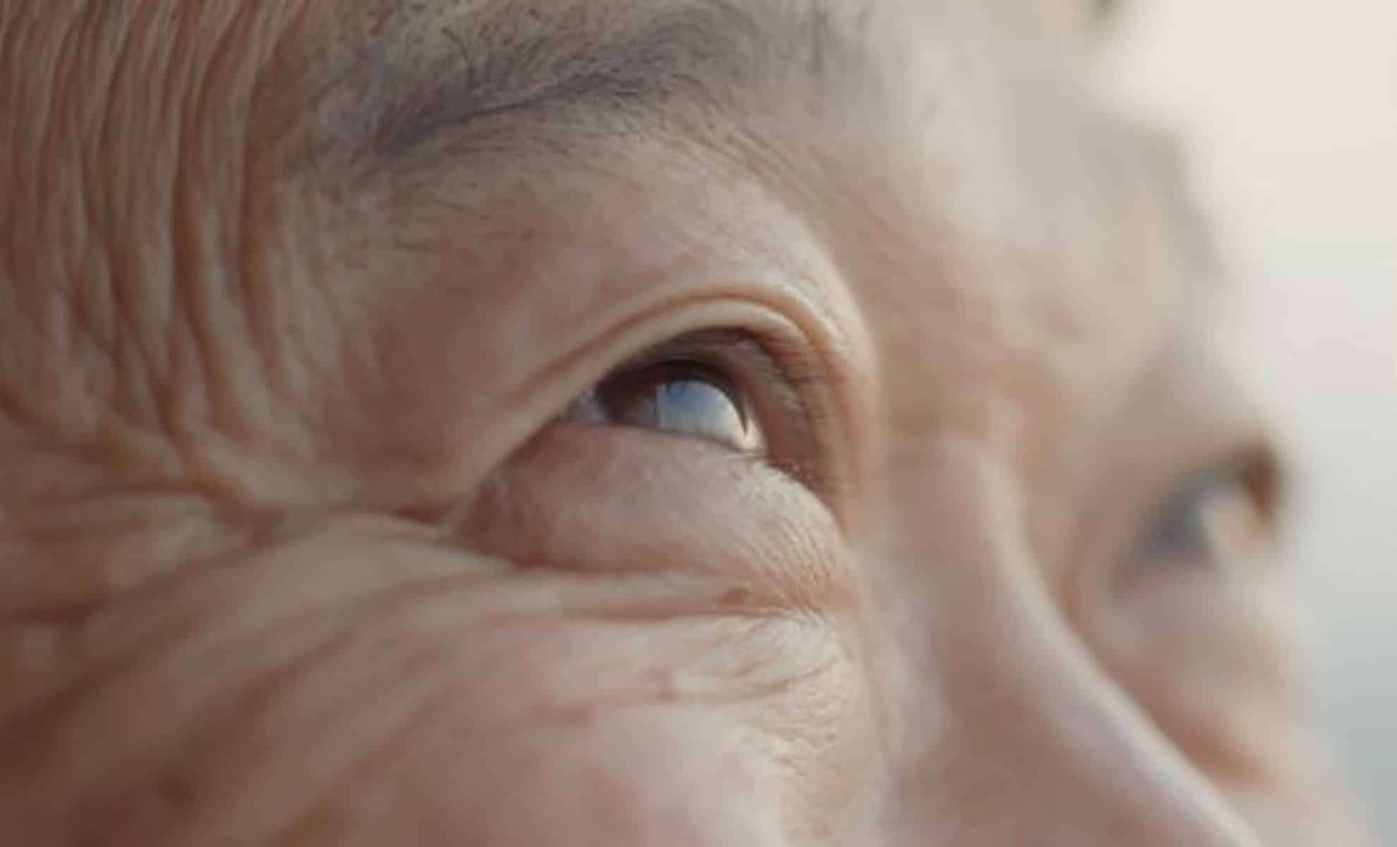 Visual Sensitivity as an Early Indicator of Dementia Years Before Symptoms Appear 