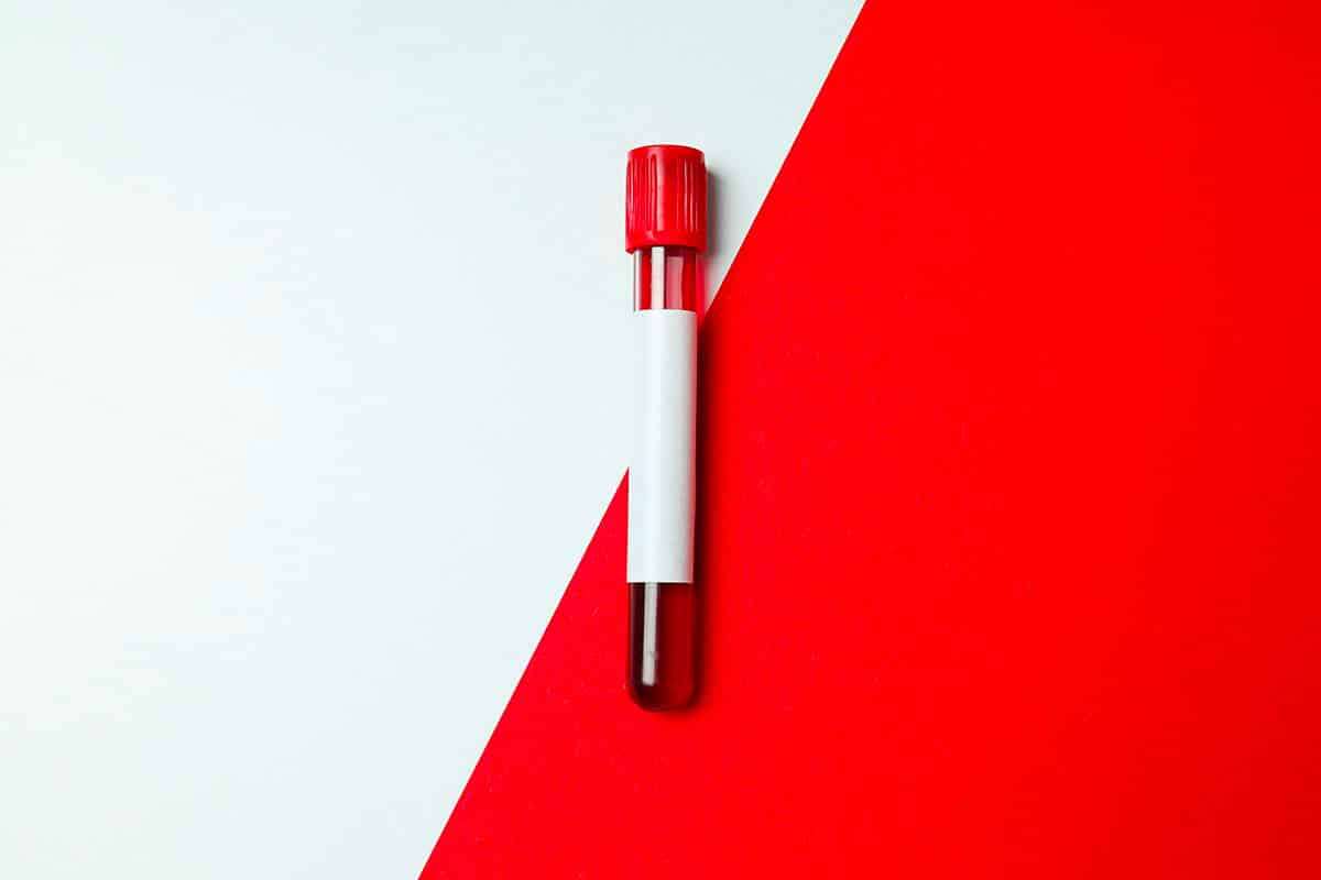 Scientists Identify a New Blood Group After Five Decades of Investigation 