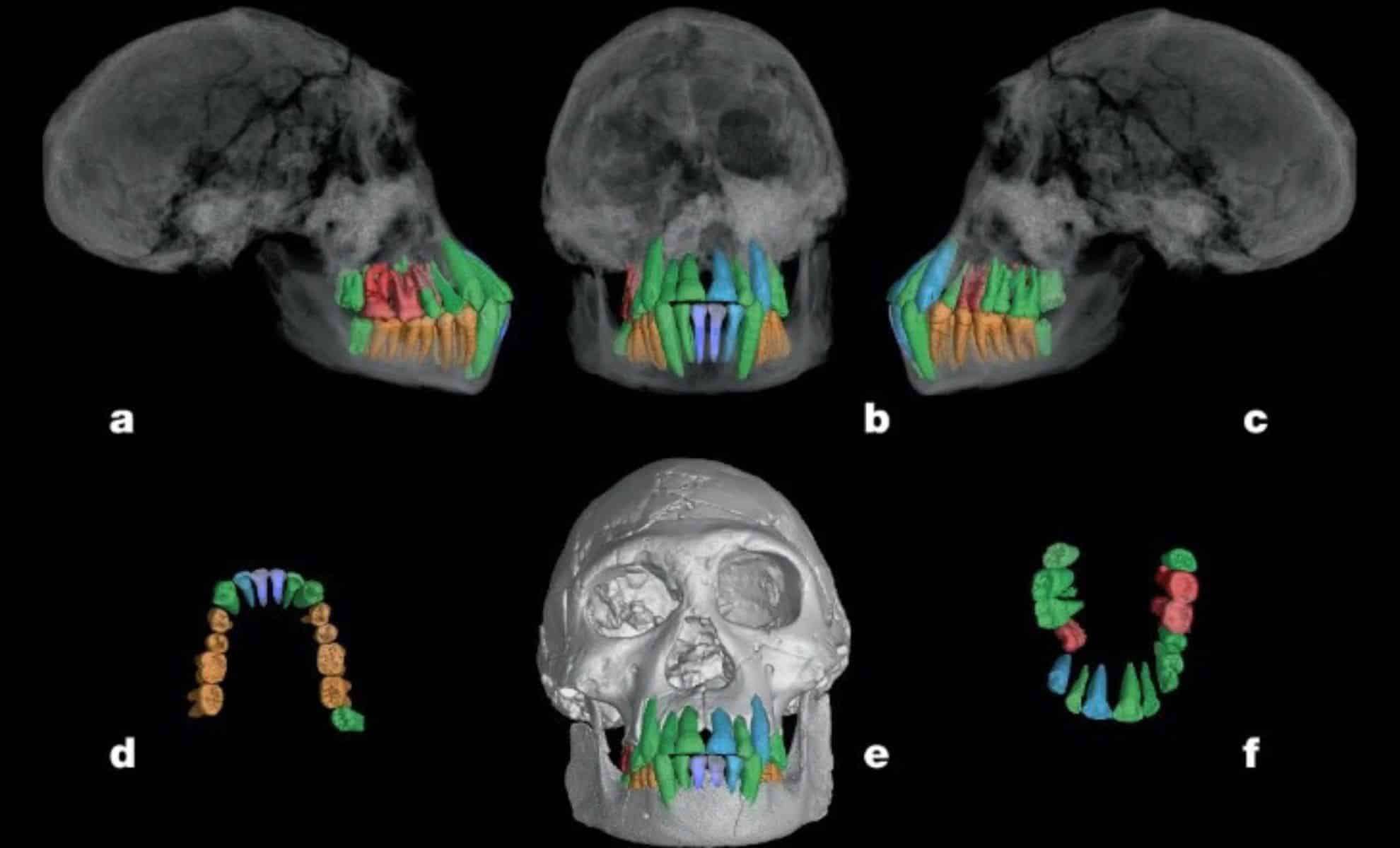 Ancient Fossil Teeth Reveal Early Origins of Extended Human Childhood 