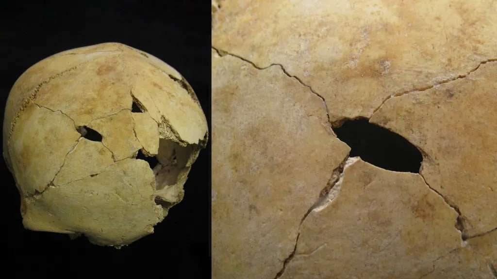 Stone-tools-had-been-used-in-acts-of-extreme-violence-1dad2249e5dcc50b86b28edf385b8c30.jpg