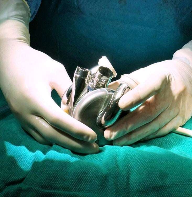 BiVACOR&reg;-Total-Artificial-Heart-121d99725623c03e80f755cb15c6f04a.jpg