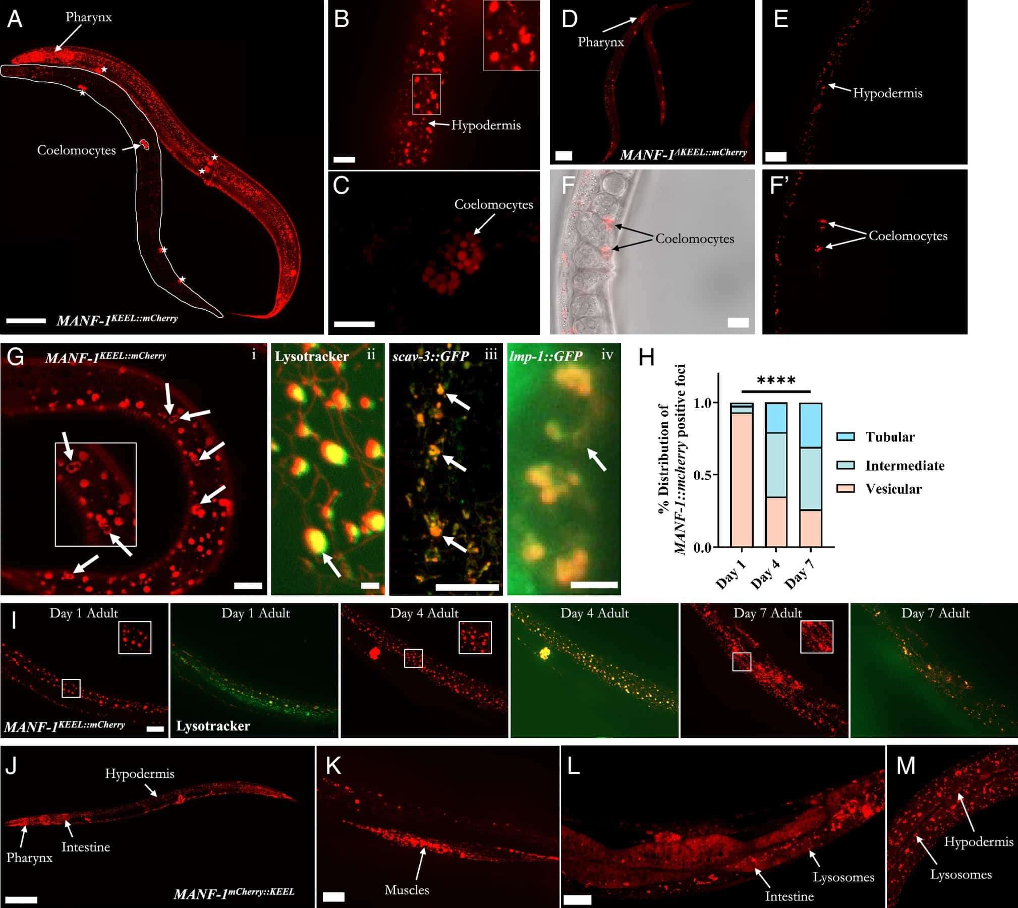 MANF-1-expression-analysis-in-MANF-1KEELmCherry-animals--e6c59844e90f80dbad5f5a78116bd3b1.jpg