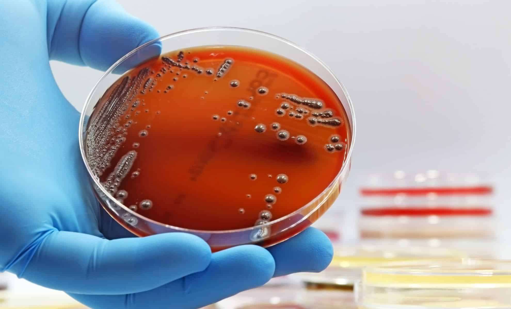 Experts Urge Caution Over Emerging Threat of Mirror-Image Bacteria 