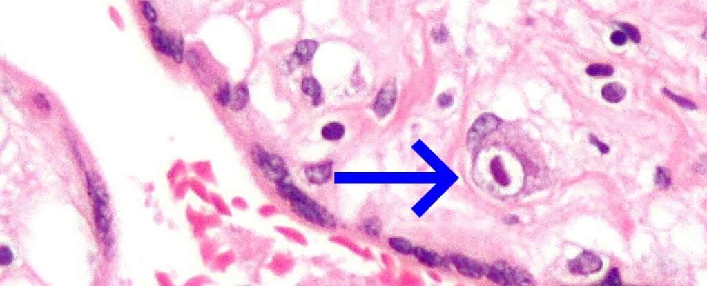CMV-infected-human-placental-cell-badea3b6f109381a03958a2ebd82e754.jpg
