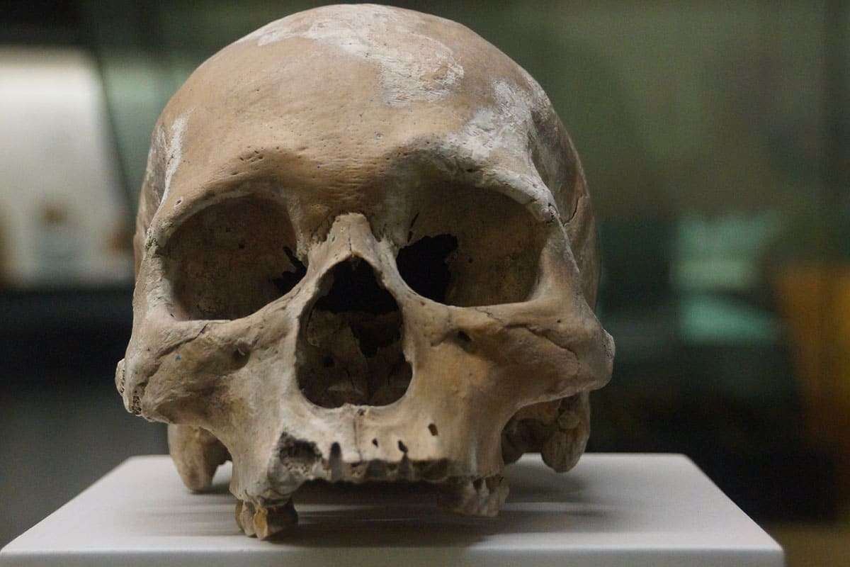 Ancient Teeth Reveal How Early Humans Fought Tooth Decay Without Modern Dentistry 