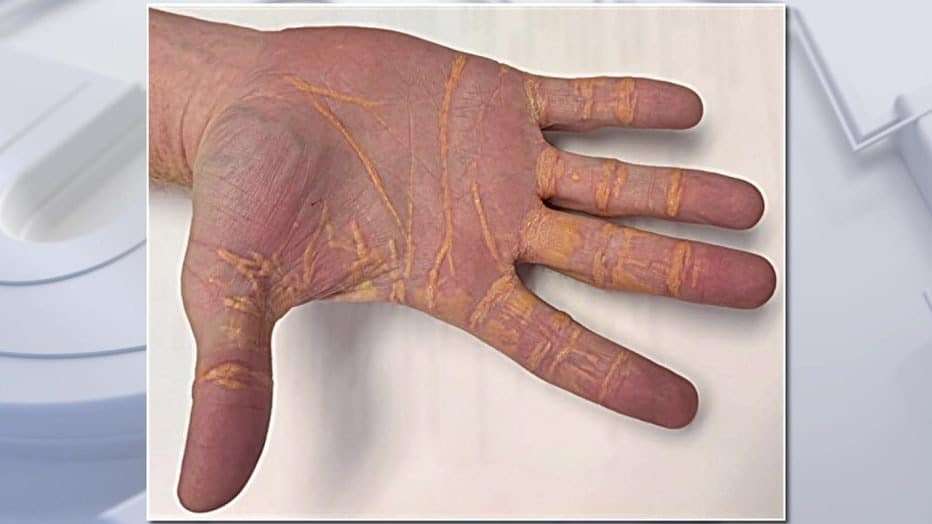 JAMA-Cardiology-b9e0cda2a2df10b6e1a1dc50a6440cb7.jpeg