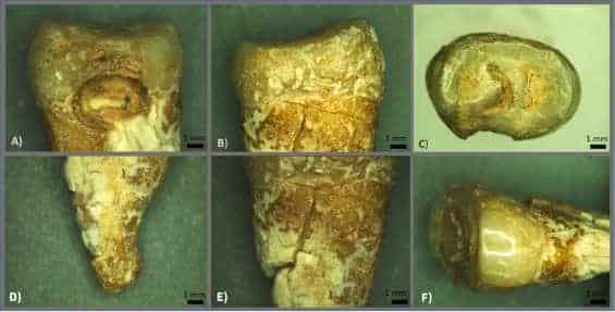 The-deceaseds-premolar-turned-out-to-be-a-real-identity-card-for-scientists-43016446e937c346e1ebd6b096224068.jpeg
