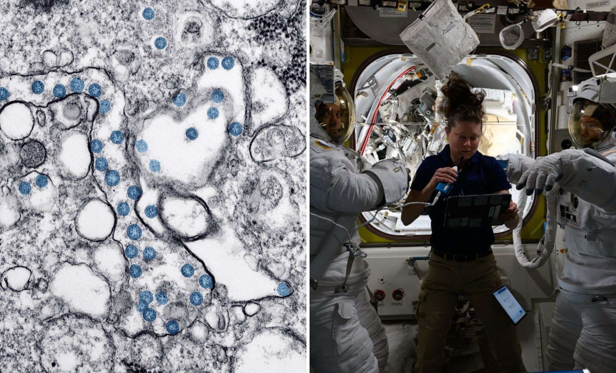 Harnessing Earth’s Microbes to Support Astronaut Health on Extended Space Voyages 