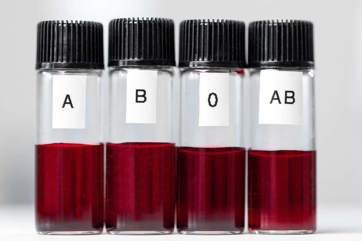 Scientists Uncover a Rare Blood Group Hidden for Over Five Decades 