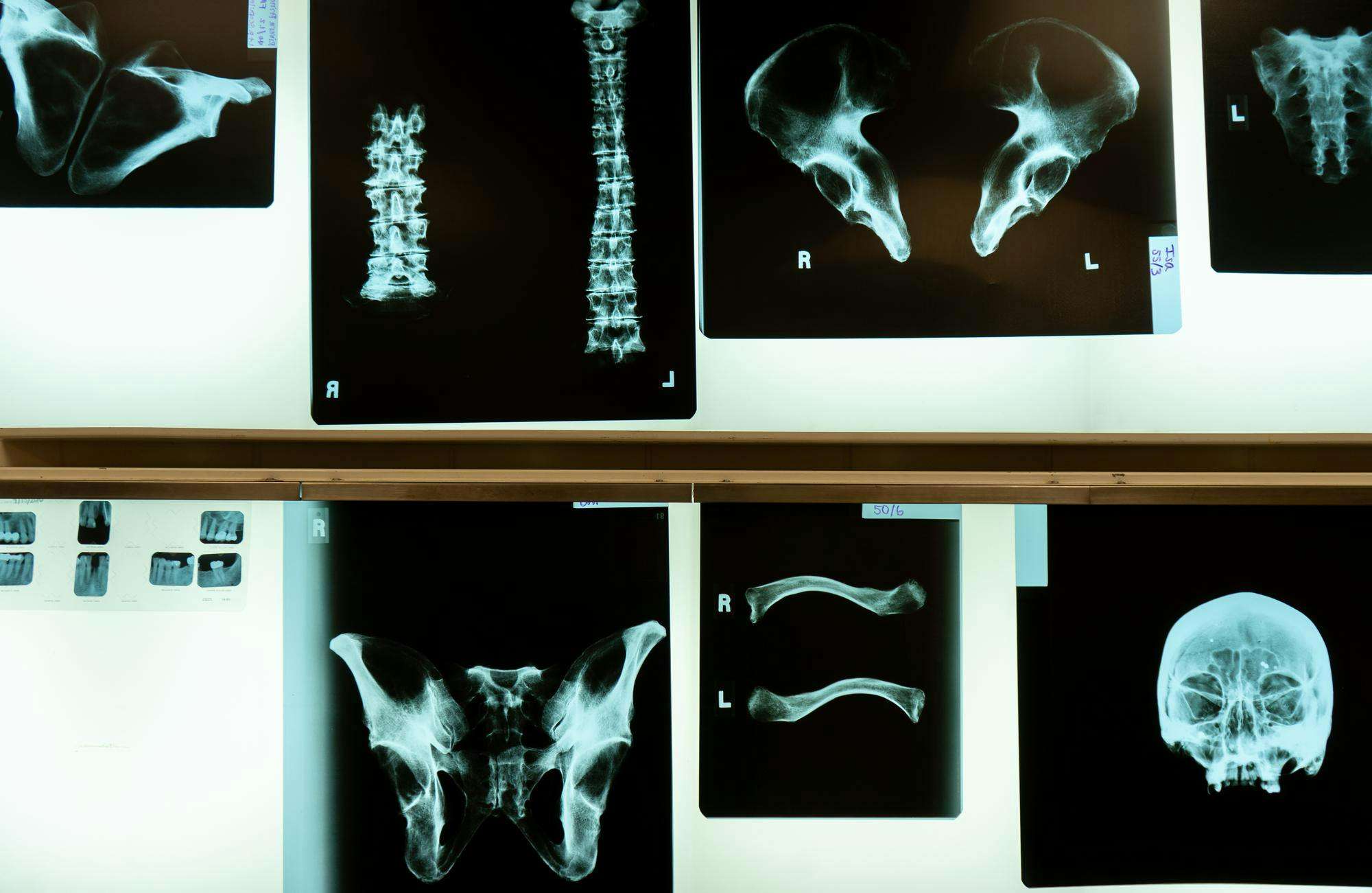 X-rays-in-the-forensic-anthropology-lab-in-Giltner-Hall-1-c6b0568260392f5afa28922e4b9720d8.jpg