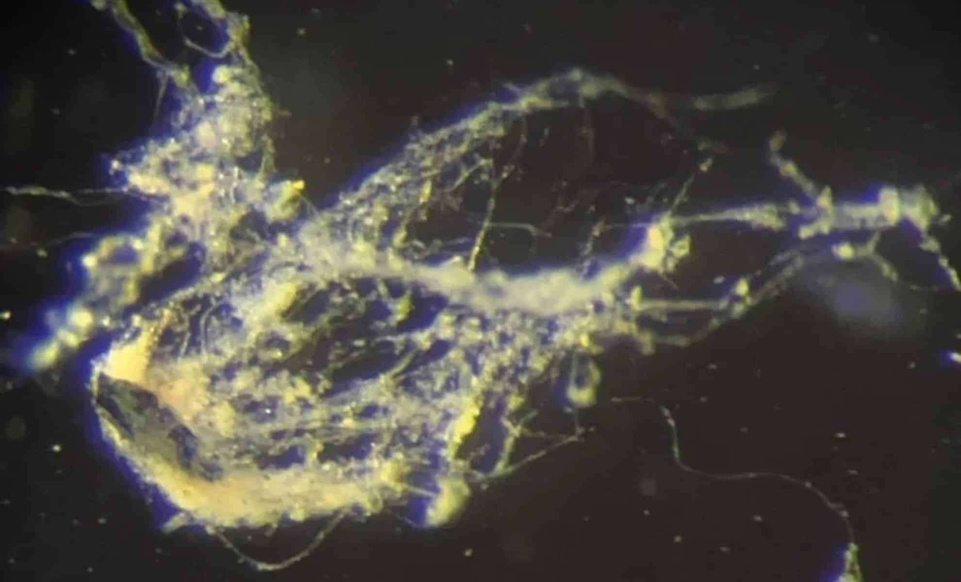 Scientists Uncover Bacterium That Channels Electricity Like a Biological Wire 
