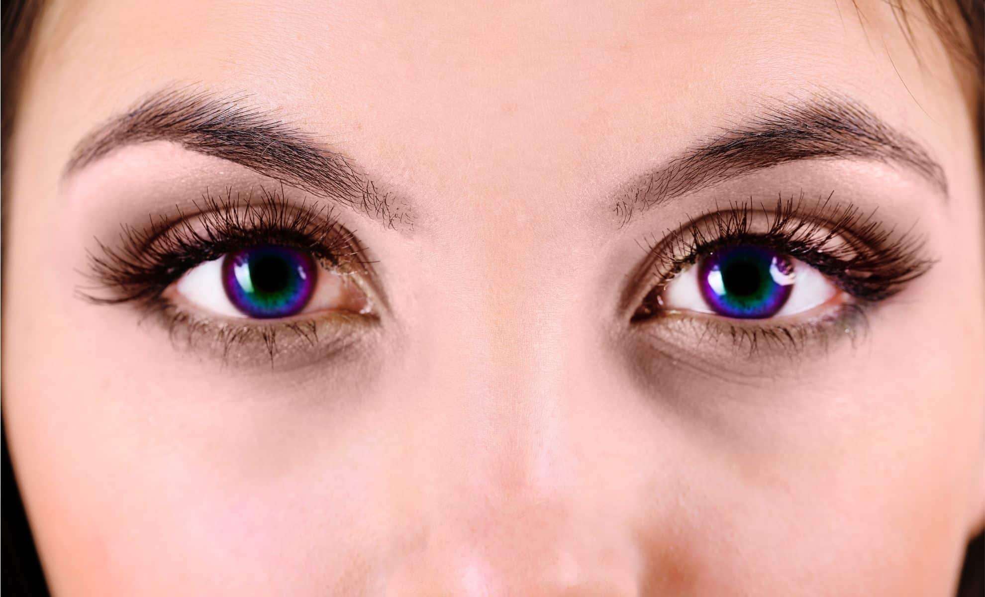The $12,000 Eye Color Makeover: A Permanent Change With Uncertain Risks 