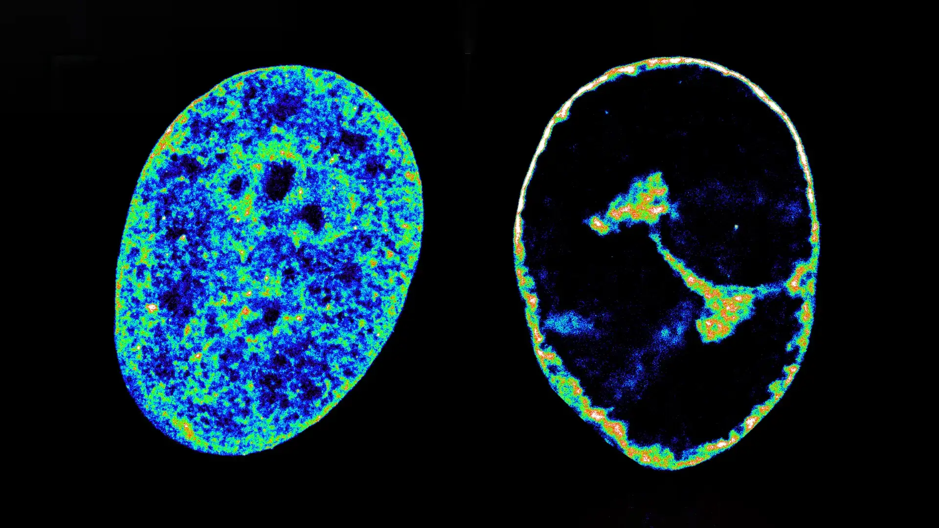 Human-Cells-Before-and-After-Infection-27e7bbea2209fd5369041ae5c7babbc4.webp