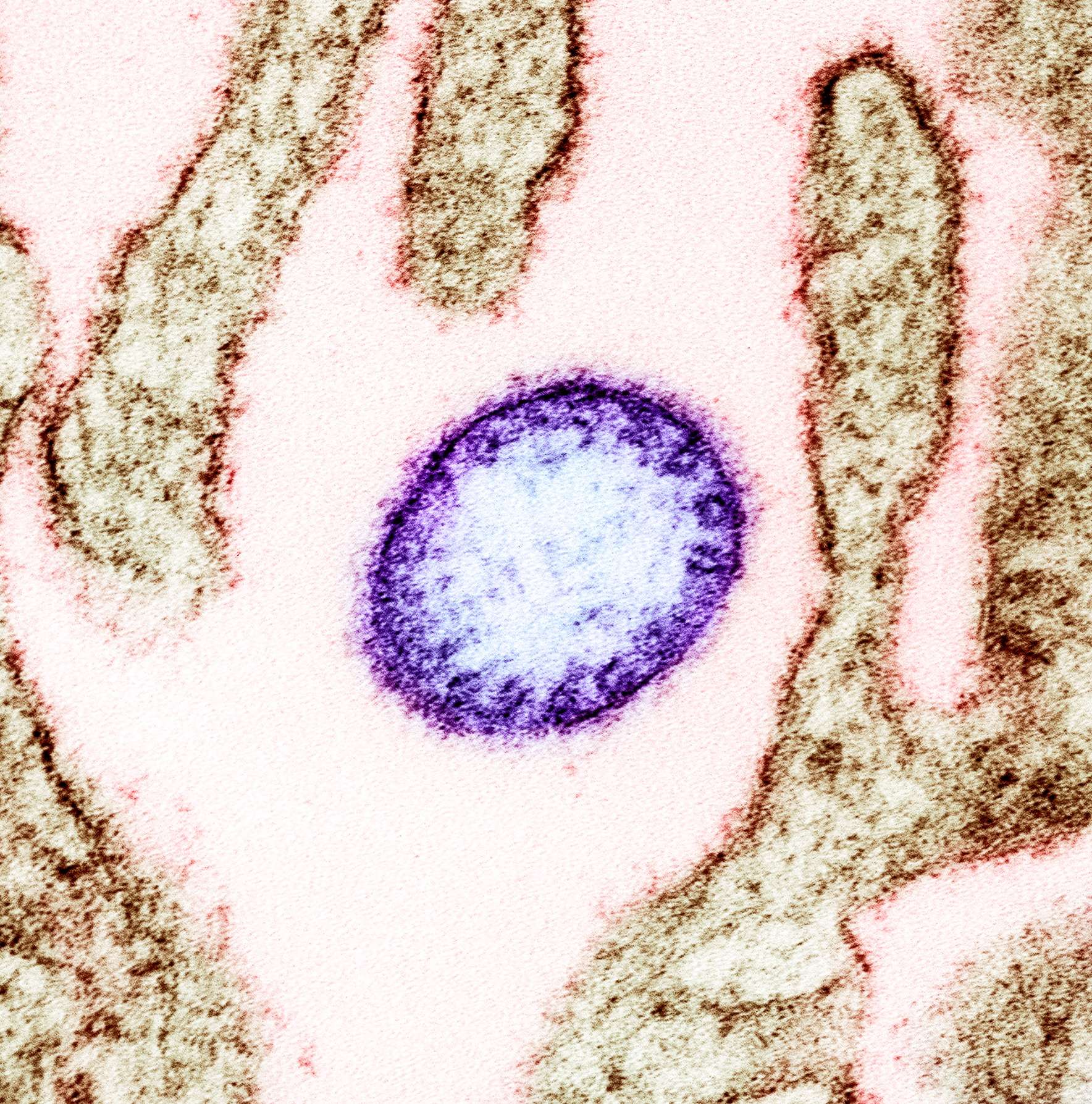 Nipah_virus_from_an_infected_VERO_cell-5a7fa58b4d4be8705218467537413835.jpg