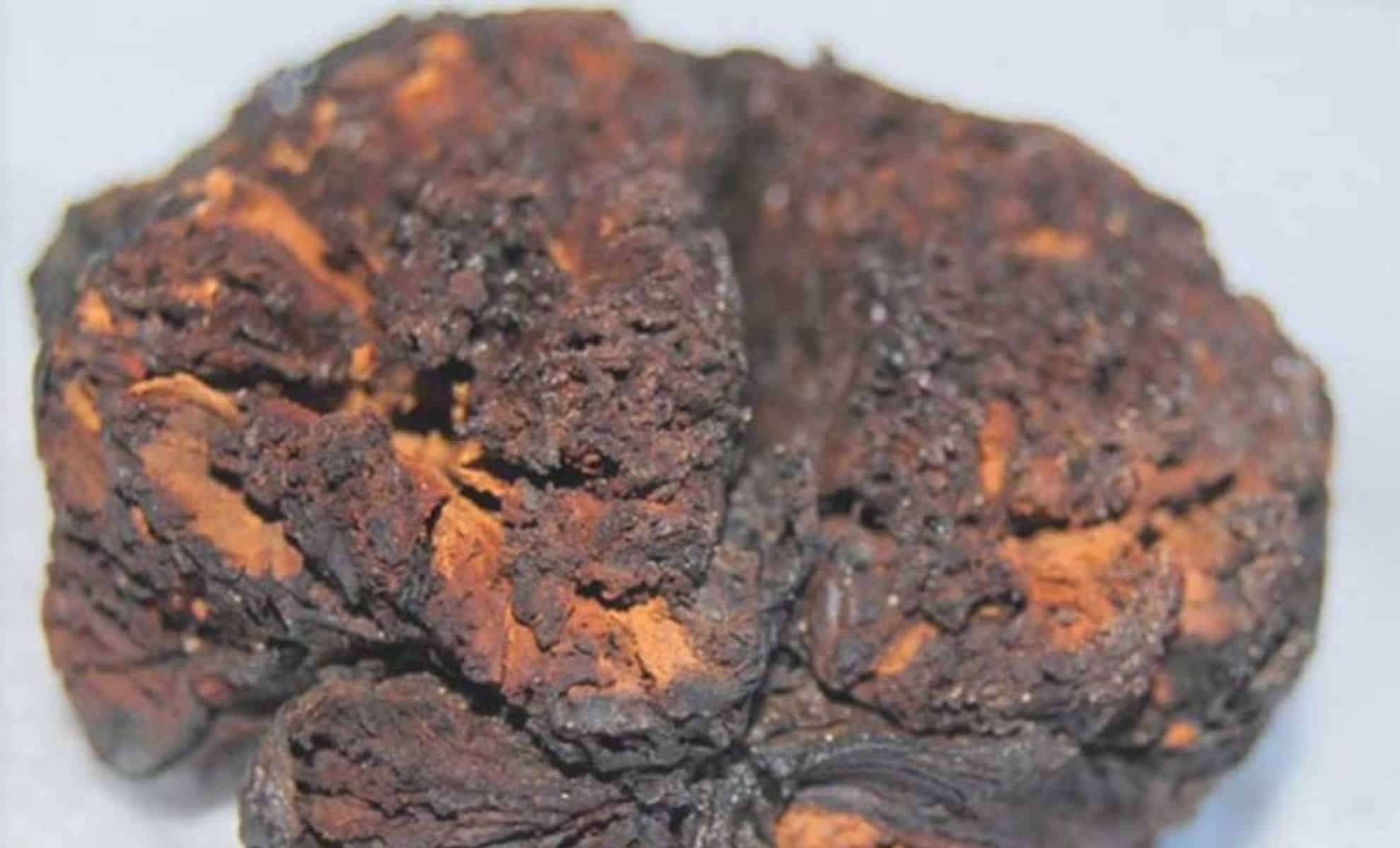 Remarkably Well-Preserved 4,000-Year-Old Brain Unearthed in Turkey 