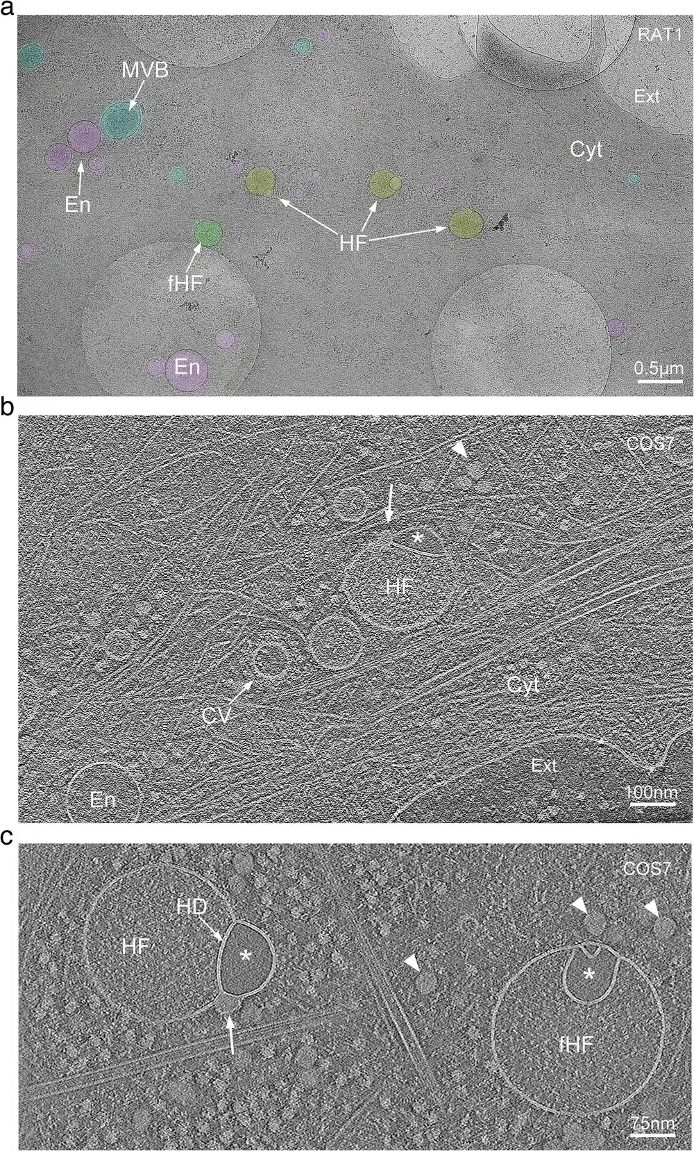 human-cells-hold-a-mysterious-structure-47d4e7c0c6fdd881f8e1a6ed15d4f3c1.webp