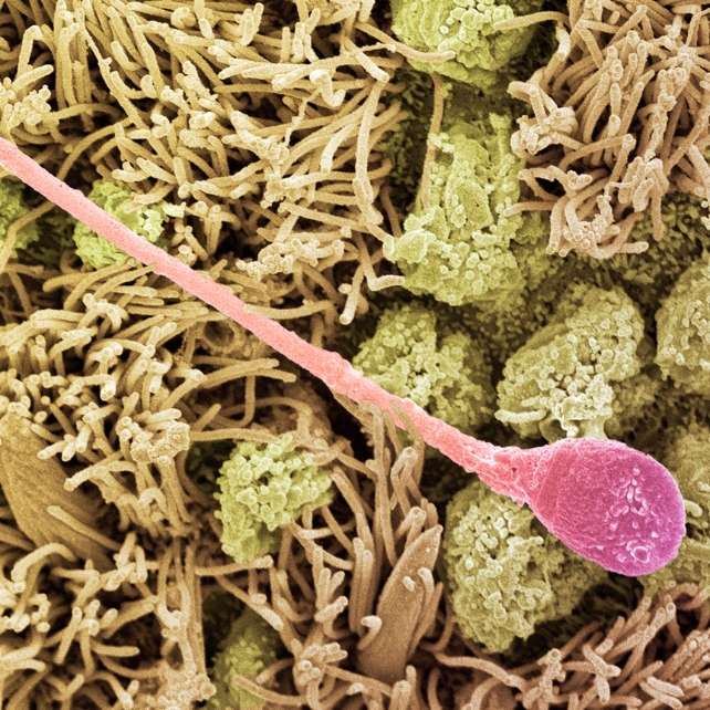 ScanningElectronMicrographOfASpermCellR_U_642-0f2741f2318a233acd6c4e8ba608bf46.jpg