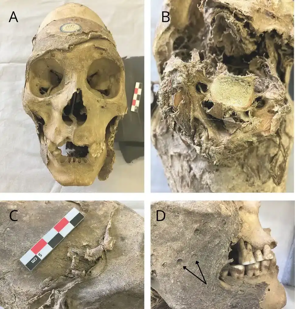 A-detailed-composite-image-of-the-mummified-head-595b3974b79eb99ac5ebf8271c144ffa.webp