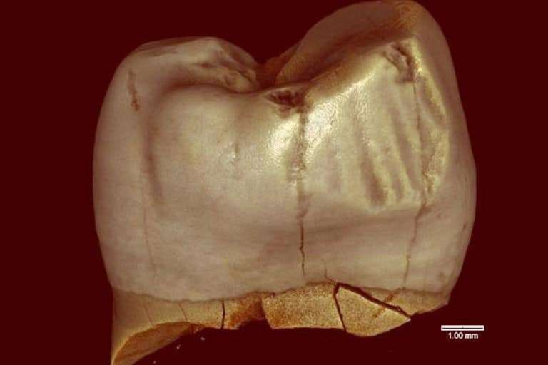 A-Neanderthal-molar-e3ab8732c49f8cffce800d8f82588df3.jpeg