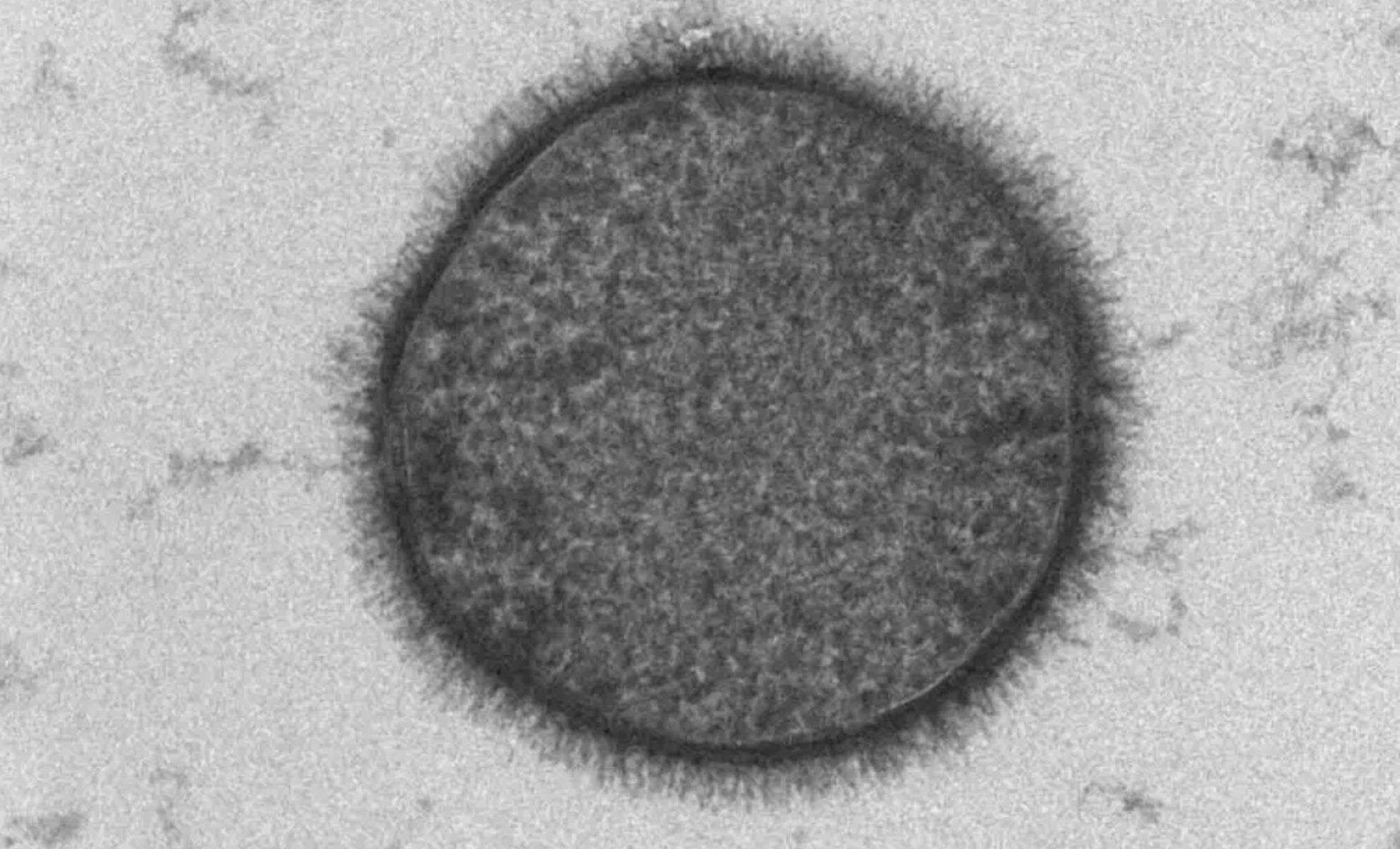 Earth Bacteria Endure Rocket Launch, Revealing Potential to Colonize Mars 