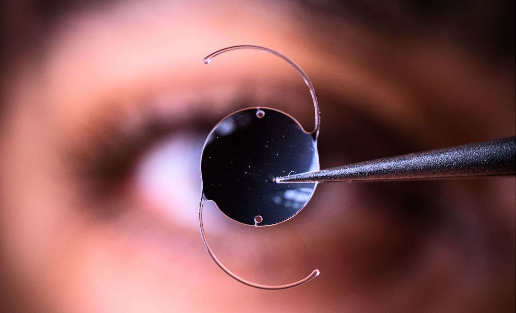 Tiny Microchip Revives Sight for Individuals with Age-Related Vision Loss 
