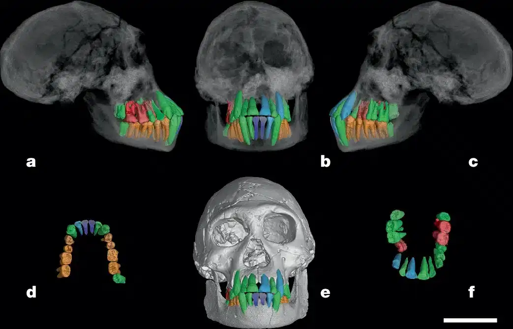 Dental-structure-of-the-Dmanisi-skull-1b1033c3b7eae6ccee4d5722a7f9015d.webp