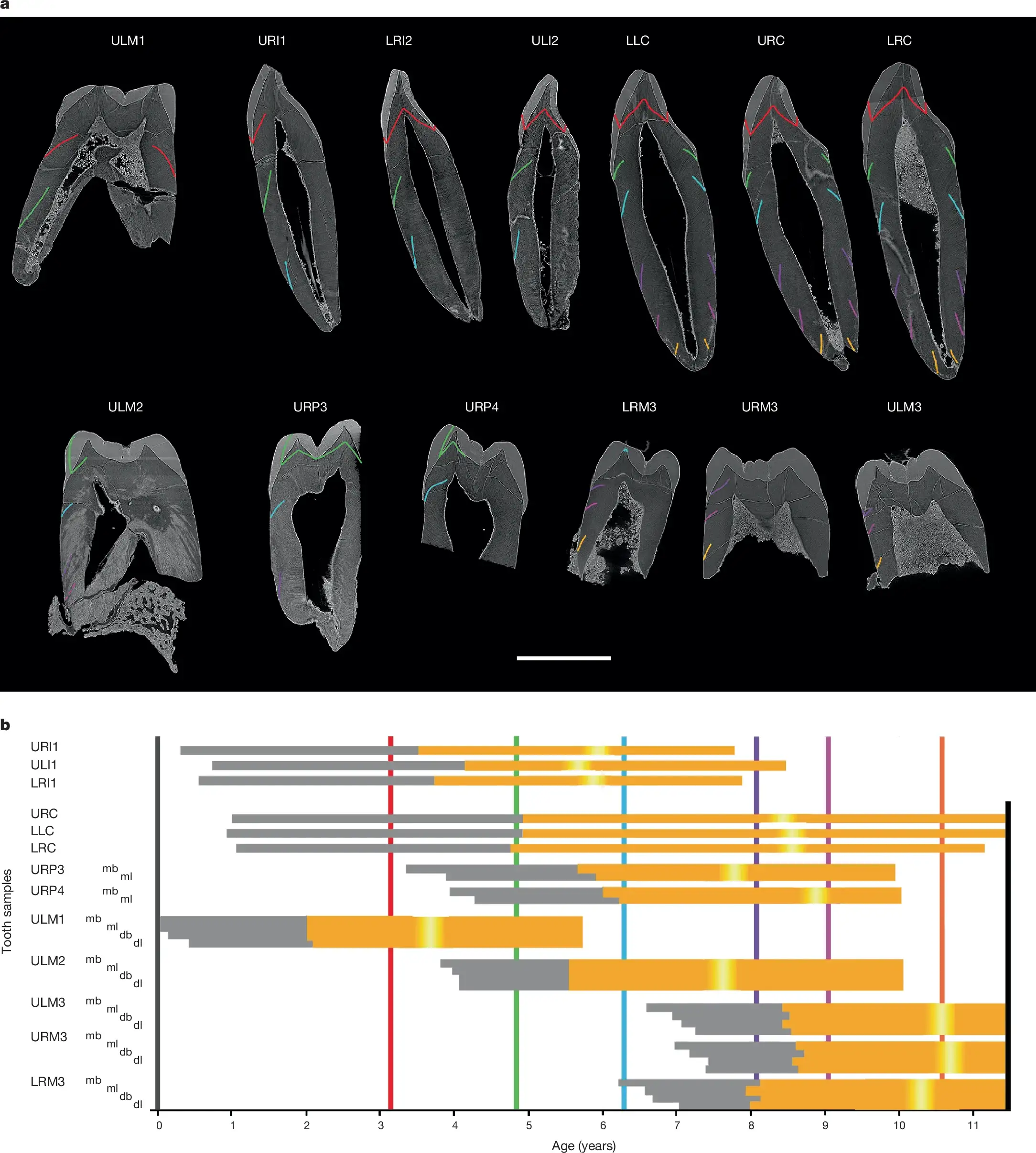 Tooth-growth-patterns-20e8394c566a16936c4a09297389d6bd.webp