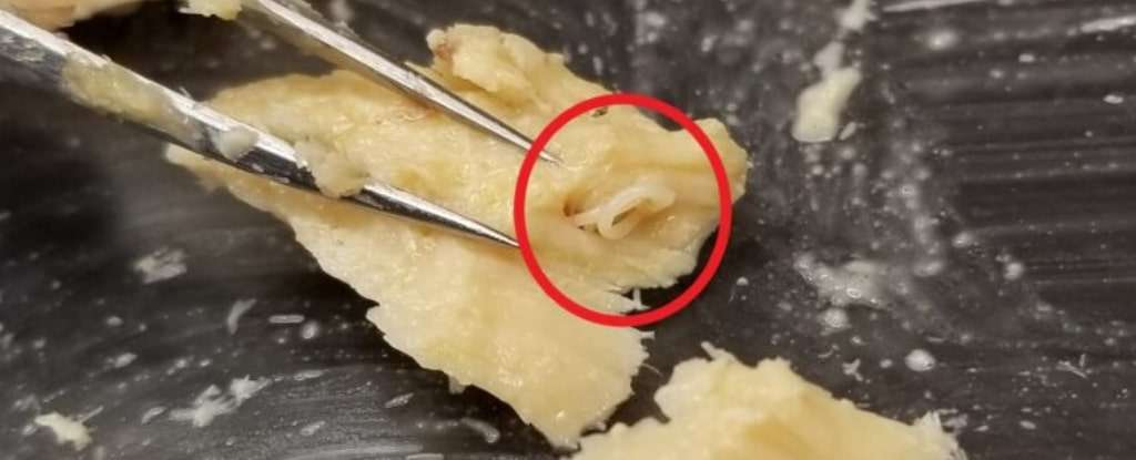 A-preserved-anisakid-parasite-visible-in-red-embedded-in-a-canned-salmon-fillet-c9a72971169a3ac9083ee5695744b592.jpg