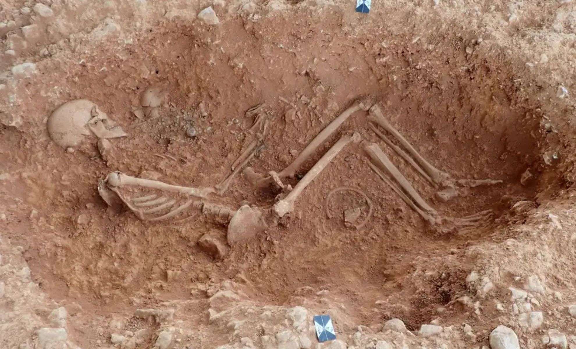 New Technique Uncovers Pregnancy Evidence in Centuries-Old Skeletons 