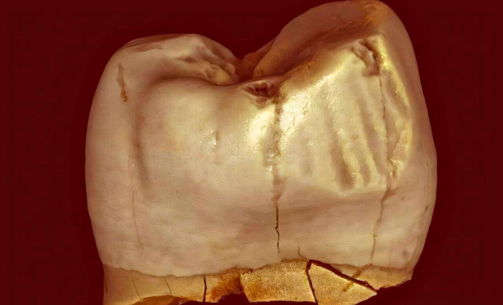 Ancient Tooth Grooves May Stem From Natural Causes, Not Early Toothpicks 