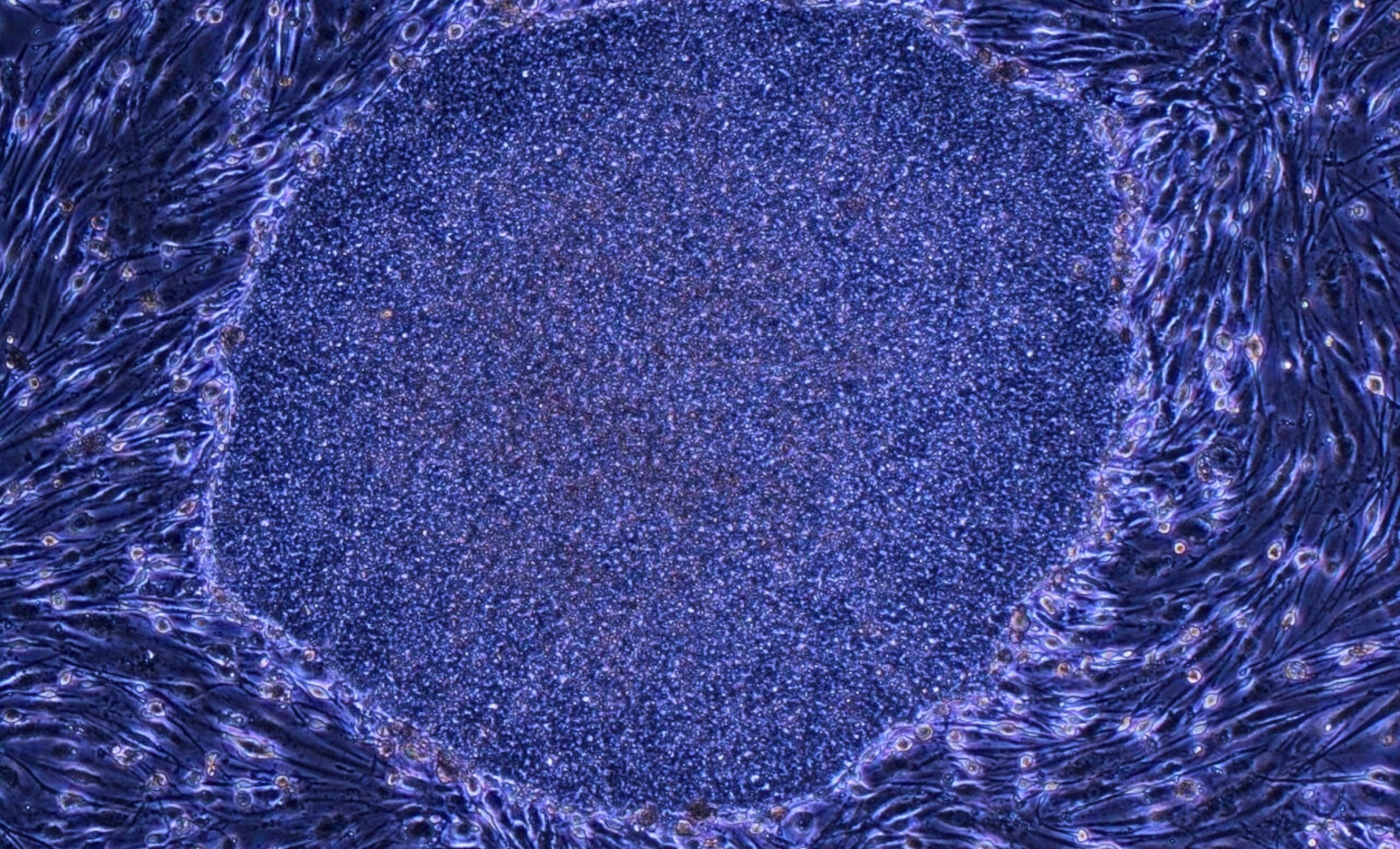 Japan Greenlights First-Ever Therapies Using Reprogrammed Human Cells 