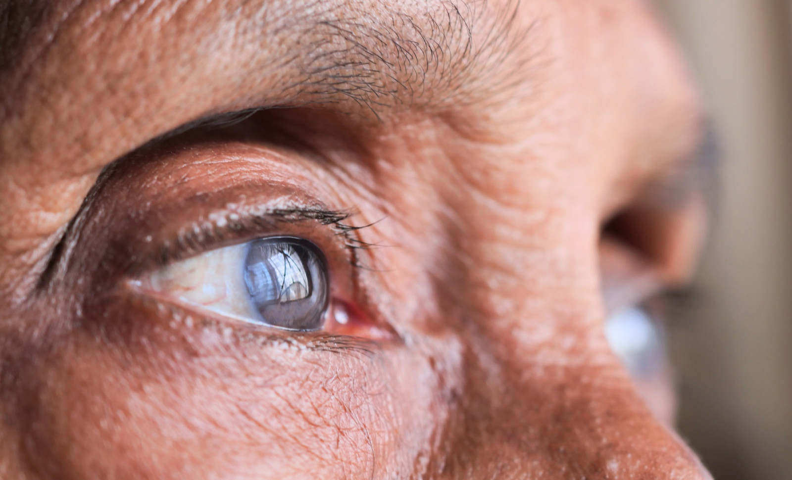 Understanding Eye Supplementation: Why It's Gaining Ground Among Eye Care Experts 