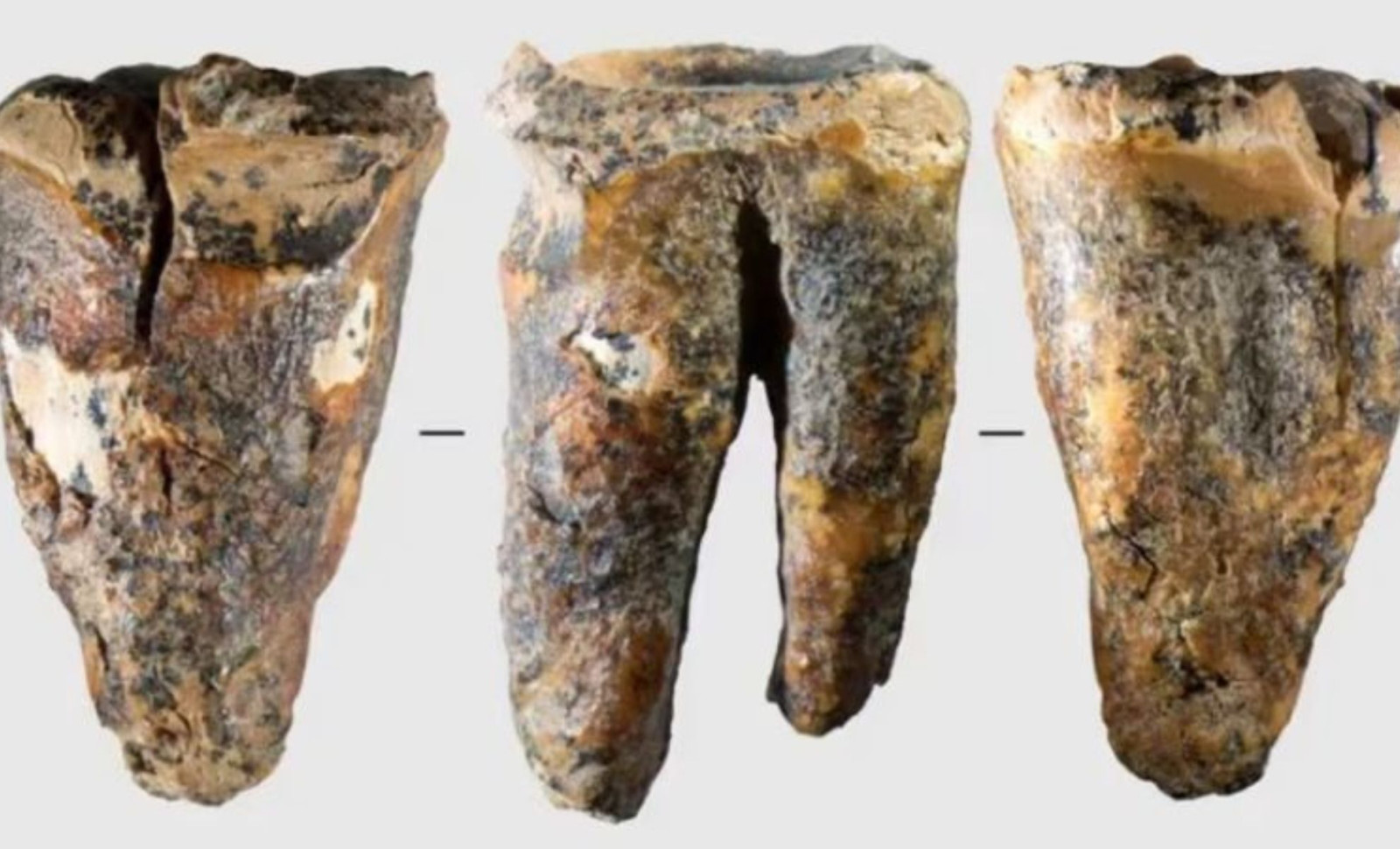59,000-Year-Old Neanderthal Tooth Unearthed in Siberia Reveals Ancient Dental Treatment 