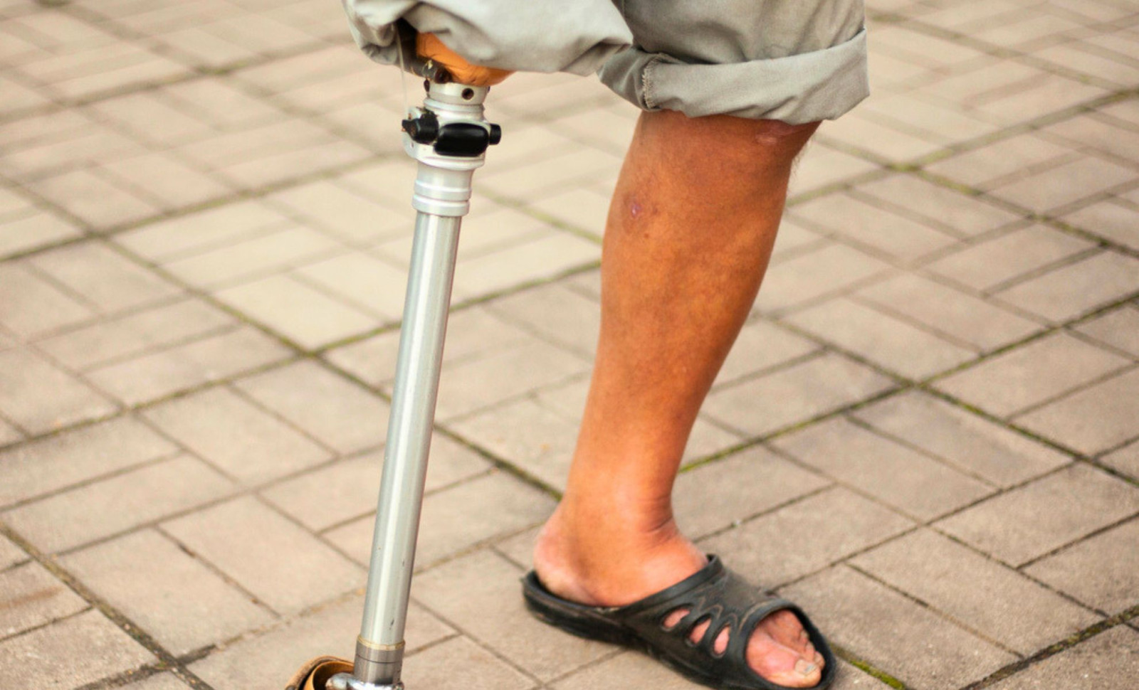 Scientists Unlock Mammalian Potential to Regenerate Lost Limbs Using Key Protein Sequence 