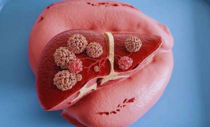 New Research Shows Common Foods Can Cut Liver Fat by Half — What You Should Know