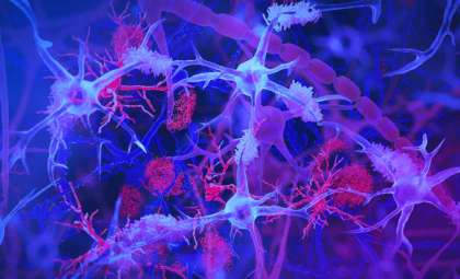 Hidden Link Between Common Gut Virus and Alzheimer’s Disease Uncovered