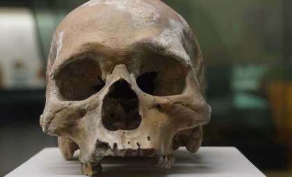 Ancient Teeth Reveal How Early Humans Fought Tooth Decay Without Modern Dentistry
