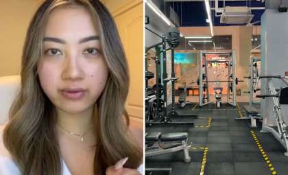 How a Gym Visit Led to Unexpected Hair Loss Due to Fungal Infection