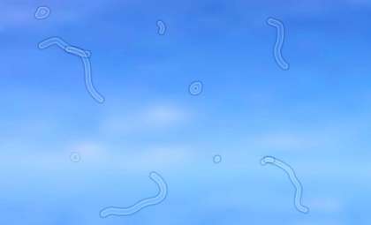 Unraveling the Mystery Behind Those Floating Spots in Your Vision