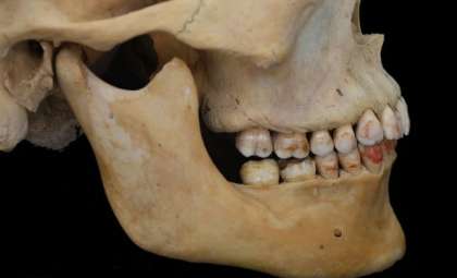 Ancient 'Red Princess' Unearthed with Rare Toxic Red-Stained Teeth Along Silk Road