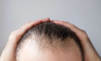 Breakthrough Discovery Reveals How to Potentially Reactivate Hair Growth and Combat Baldness