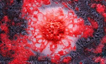 French Scientist Pioneers Breakthrough to Halt Cancer Spread Responsible for Majority of Deaths