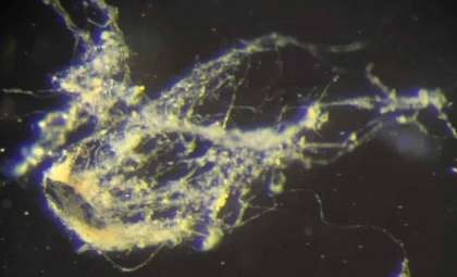 Scientists Uncover Bacterium That Channels Electricity Like a Biological Wire