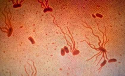 Antibiotic-Resistant Typhoid Fever Is Escalating into a Severe Global Health Crisis
