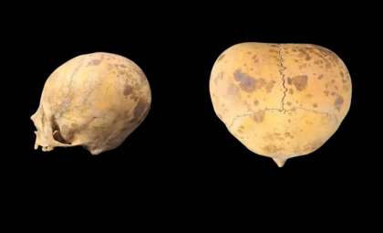 Ancient Cranial Modification in Argentina Reveals Rich Cultural History Behind Unusual Skull Shape