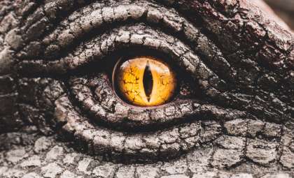Woman’s Rare Brain Disorder Transforms Faces Into Dragons