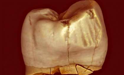 Ancient Tooth Grooves May Stem From Natural Causes, Not Early Toothpicks