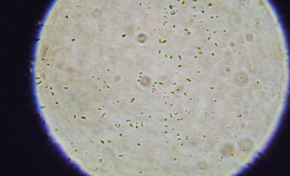 Earth’s Hidden ‘Zombie’ Bacteria May Have Been Carried to Mars by NASA’s Spacecraft