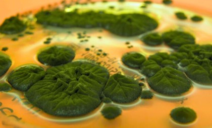 Remarkable Radiation-Utilizing Fungus Discovered at Chernobyl Reveals Unprecedented Survival Strategy