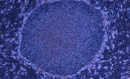 Japan Greenlights First-Ever Therapies Using Reprogrammed Human Cells